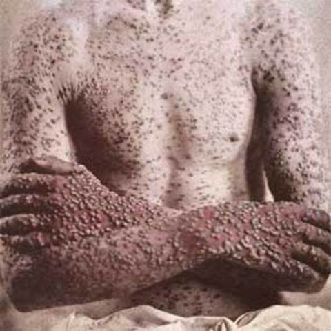 Date of the first known outbreak of AIDS