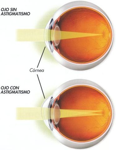 2.Motivo de Consulta