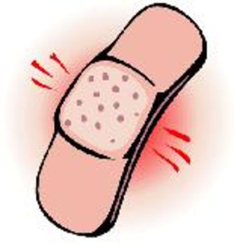 I had had a serious injury in my eyebrow. (PAST PERFECT)