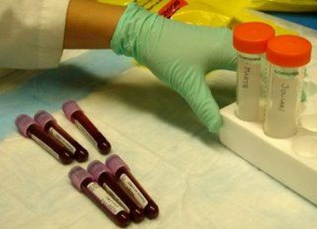 Examenes Compleentarios