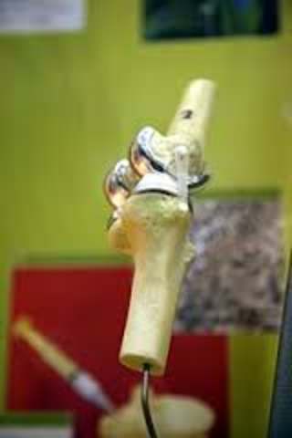 BIOMATERIAL - TITANIO