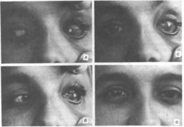 BIOMATERIAL - Hodroxiapatia.