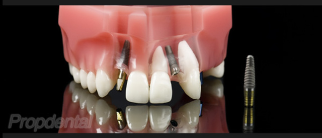 Biomaterial. Titanio