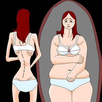 Timeline: Diario de una anorexica