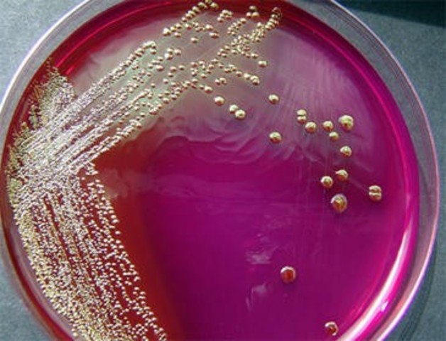 BIOPLÁSTICO ANTIMICROBIANO