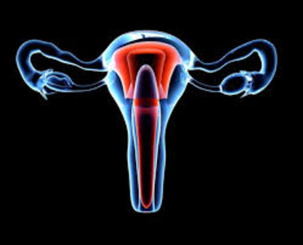 World's first mother-to-daughter uterus transplant undertaken at the University of Gothenburg