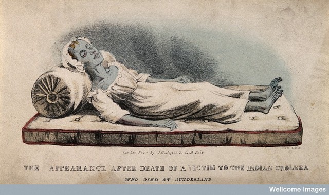 Cholera outbreak in Britain