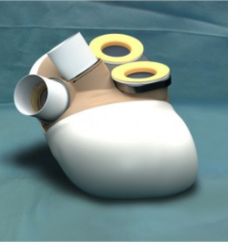 Primer implante de un corazón artificial en un ser humano