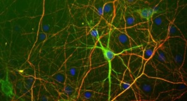 Programmable Brain Cells