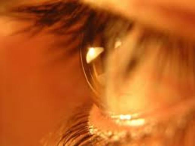 Órgano bioartificial