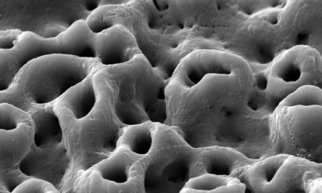 Titanio: biomaterial.