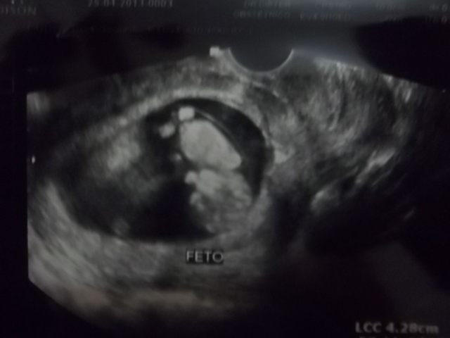 Sensação única: Saber que dentro de você existe um outro alguém...