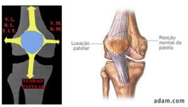 Instabilidade Patelar!!!