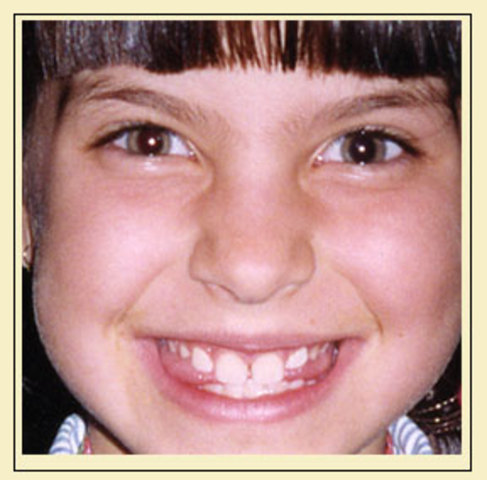 2nd May, 1995, I dropped my first tooth