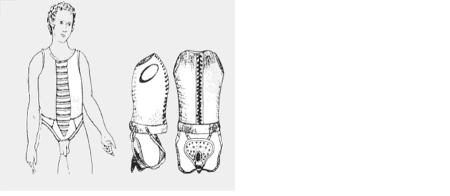 Artefactos antimasturbacion