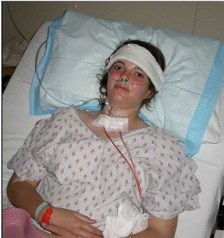 Thyroid Cancer Surgery