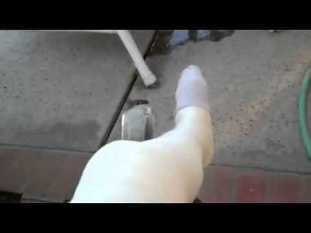 Broke my leg and hip