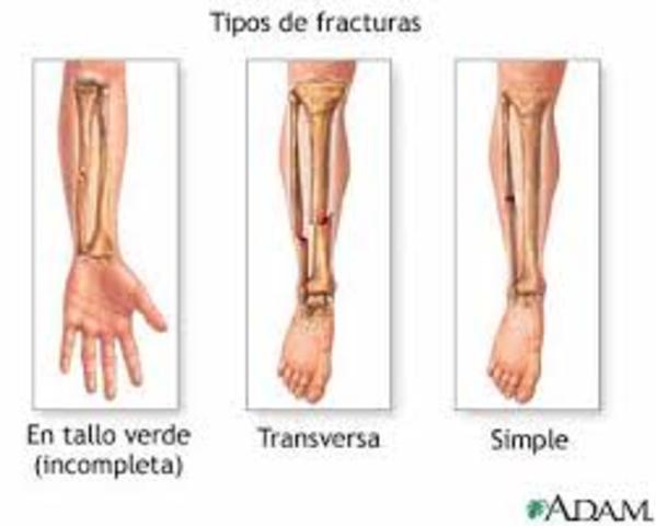 Tratamiento Racional de las Fracturas y Luxaciones