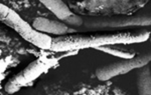 Teoría del germen de la enfermedad