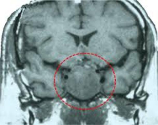 Descubrimiento fisiológico del cerebro.