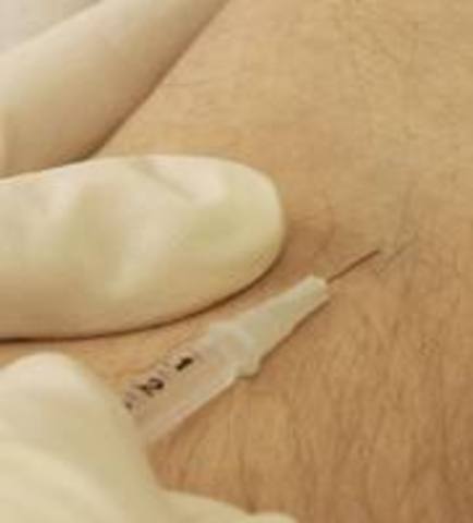 INYECCION INTRAVENOSA