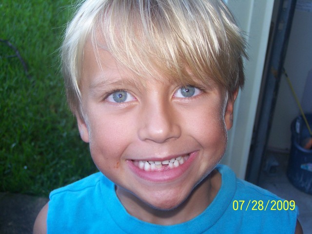 J lost his first tooth - FINALLY!