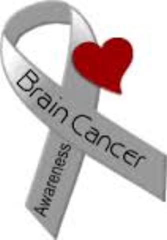 Grnadma's Cancer Returned: This Time in the form of Brain Cancer