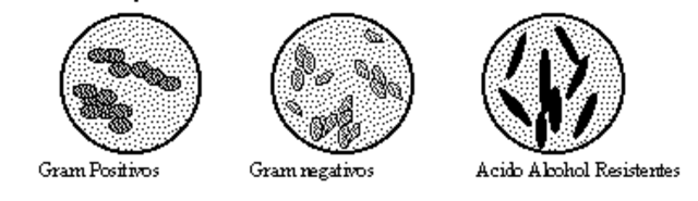 bacterias eran causa de multitud de enfermedades