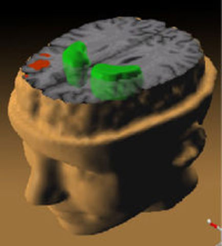 Demostración de la neurotransmisión