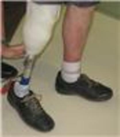 Protesis FABIO. Biomateriales.