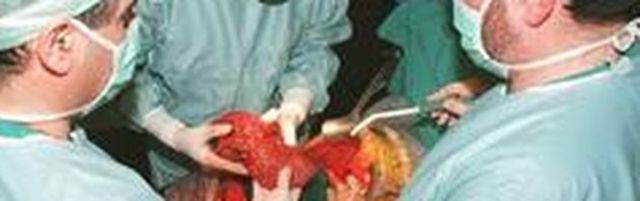 Trasplante de pulmon