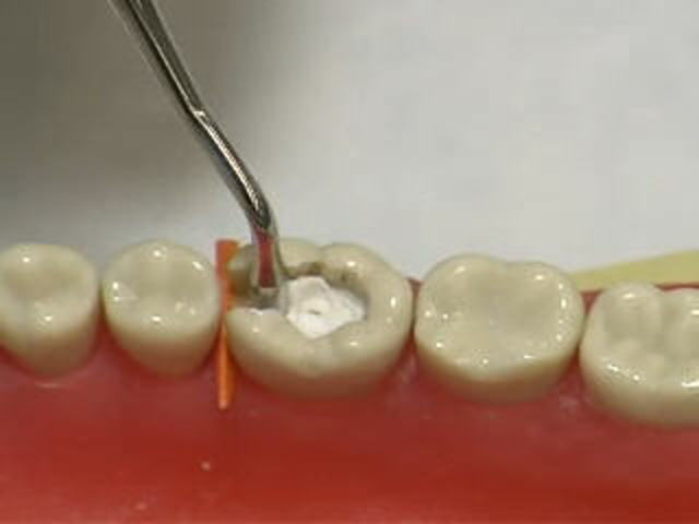 El Eugenol, Universidad Complutense de Madrid. Biomateriales.