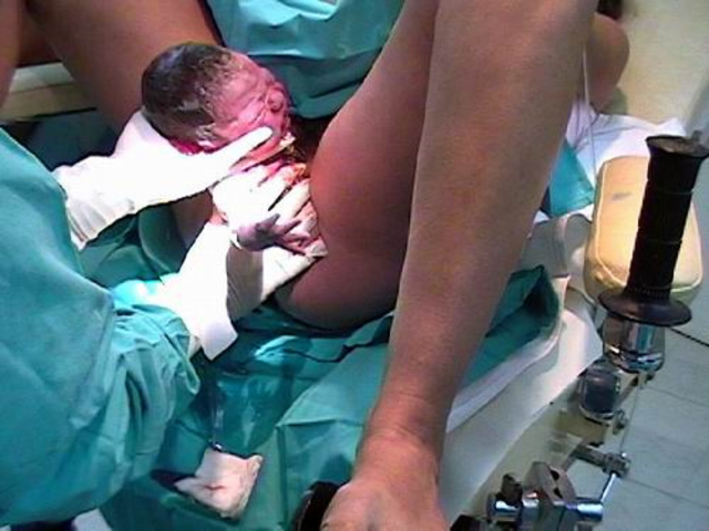 Autorizacion a los cirujanos de asistir a los partos