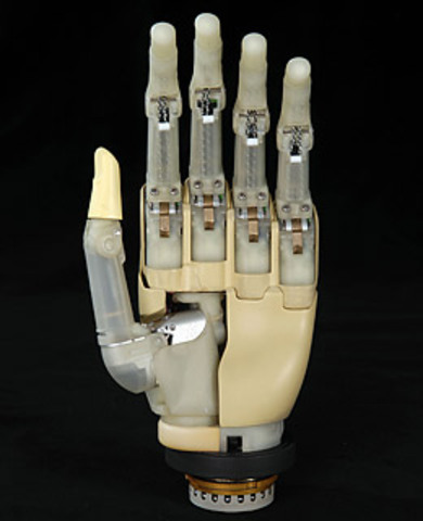 The Bionic Hand