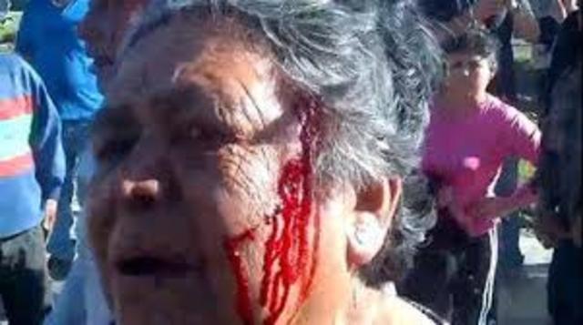 AGRESION A LOS MANIFESTANTES