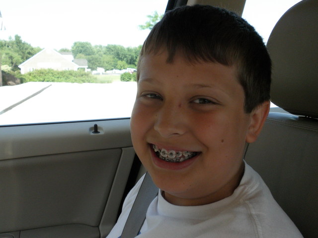 When I Got Braces