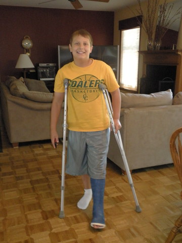 First Broken Bone/Cast