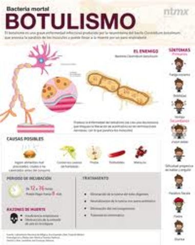 botulismo