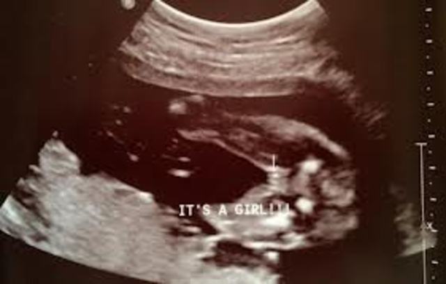 Sex is Determined (week 16)