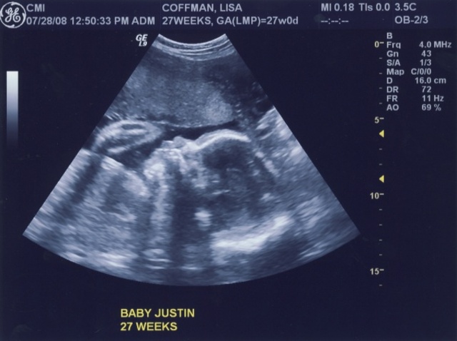 Fully Functioning (28 Weeks)