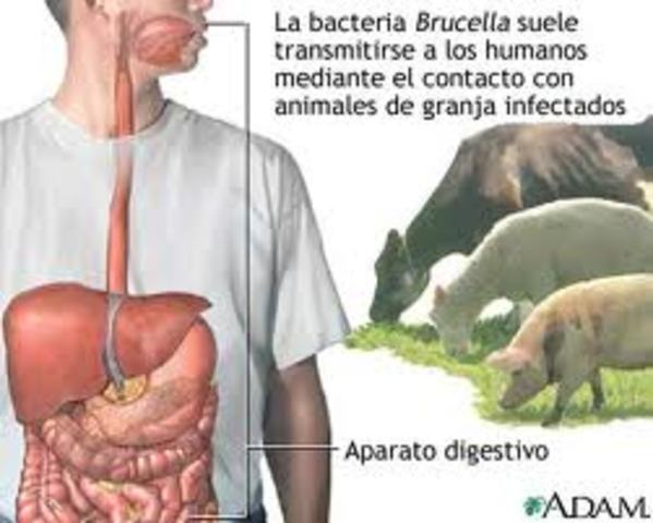 brucelosis