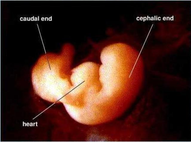 1st Trimester -1st Month