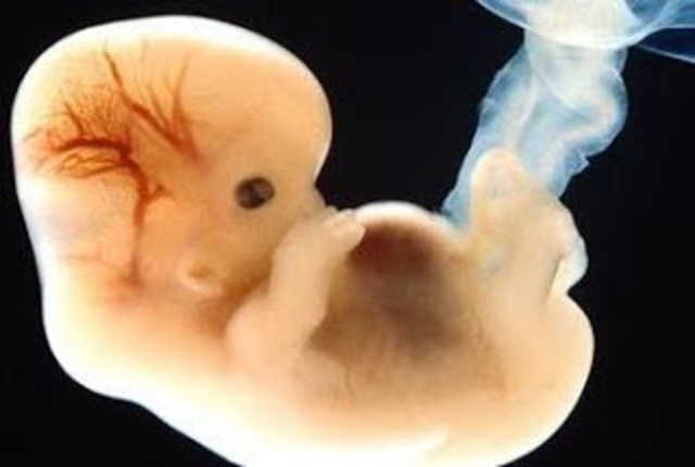 First Trimester - 2nd Month