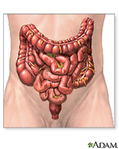 Bowel Obstruction