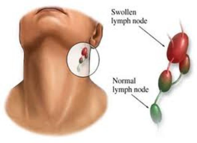 Patient admitted to Children's Hospital