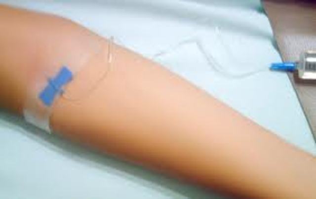Inyeccion Intravenosa