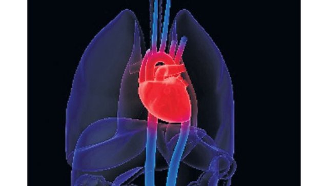 primera pericardiocentesis