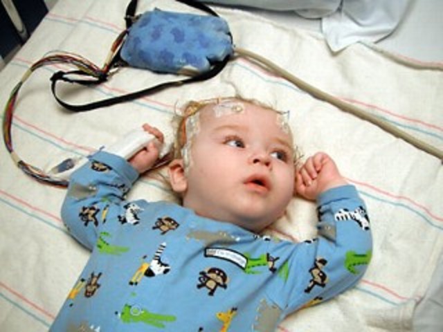 2nd child has siezures