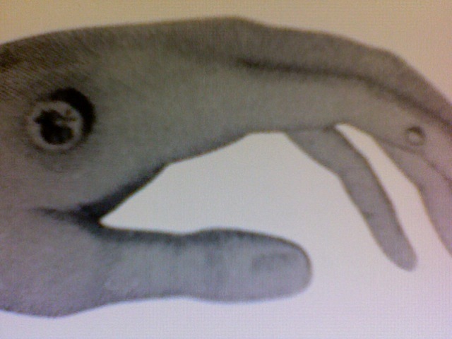 Jenner 1st becomes interested in smallpox and cowpox tie