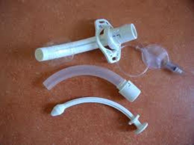 Tracheostomy Placed